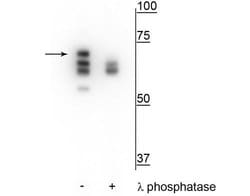 Invitrogen Phospho-HSP70 (Ser153) Polyclonal Antibody 100 &mu;L | Buy Online | Invitrogen&trade; | Fisher Scientific