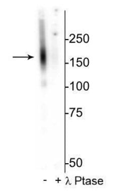 Invitrogen™ Phospho-SLC12A3 (Thr53) Polyclonal Antibody