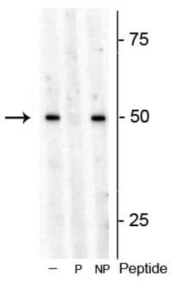 Invitrogen Phospho-p70 S6 Kinase (Thr449) Polyclonal Antibody 100 &mu;L | Buy Online | Invitrogen&trade; | Fisher Scientific