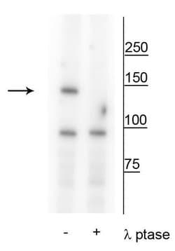Invitrogen Phospho-FANCI (Ser559) Polyclonal Antibody 100 &mu;L; Unconjugated:Antibodies,