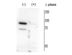 Invitrogen Phospho-PANK4 (Thr63) Polyclonal Antibody 100 &mu;L; Unconjugated:Antibodies,
