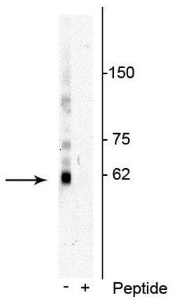 Invitrogen Phospho-SQSTM1 (Thr269, Ser272) Polyclonal Antibody 100 &mu;L | Buy Online | Invitrogen&trade; | Fisher Scientific