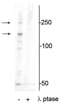 Invitrogen Phospho-XIRP1 (Ser295) Polyclonal Antibody 100 &mu;L; Unconjugated:Antibodies,