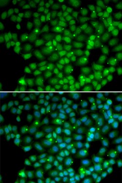 Invitrogen MUTYH Polyclonal Antibody 100 &mu;L; Unconjugated:Antibodies,