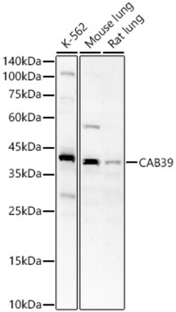 Invitrogen CAB39 Polyclonal Antibody 100 &mu;L | Buy Online | Invitrogen&trade; | Fisher Scientific