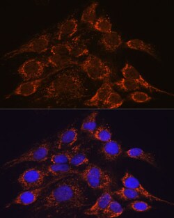 Invitrogen HPS4 Polyclonal Antibody 100 &mu;L; Unconjugated:Antibodies,