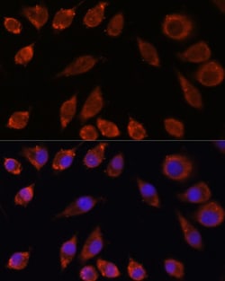 Invitrogen HPS4 Polyclonal Antibody 100 &mu;L; Unconjugated:Antibodies,