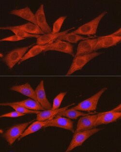 CK2 alpha-2 Polyclonal Antibody:Antibodies, Polyclonal