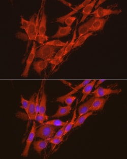 CK2 alpha-2 Polyclonal Antibody:Antibodies, Polyclonal