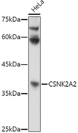 CK2 alpha-2 Polyclonal Antibody:Antibodies, Polyclonal