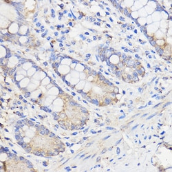 Invitrogen WBSCR27 Polyclonal Antibody 100 &mu;L; Unconjugated:Antibodies,