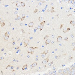 Invitrogen WBSCR27 Polyclonal Antibody 100 &mu;L; Unconjugated:Antibodies,
