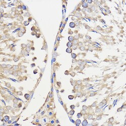 Invitrogen WBSCR27 Polyclonal Antibody 100 &mu;L; Unconjugated:Antibodies,