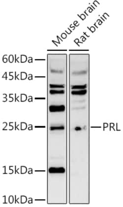 Invitrogen Prolactin Polyclonal Antibody 100 &mu;L; Unconjugated:Antibodies,