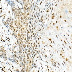 Invitrogen KIAA1429 Polyclonal Antibody 100 &mu;L; Unconjugated:Antibodies,