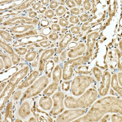 Invitrogen KIAA1429 Polyclonal Antibody 100 &mu;L; Unconjugated:Antibodies,