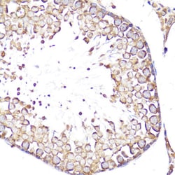 Invitrogen CD62L Polyclonal Antibody 100 &mu;L; Unconjugated:Antibodies,