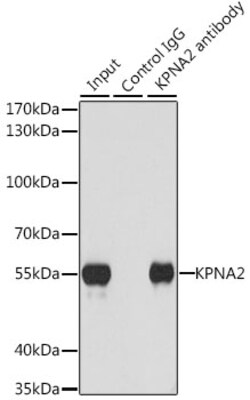 Invitrogen KPNA2 Polyclonal Antibody 100 &mu;L; Unconjugated:Antibodies,