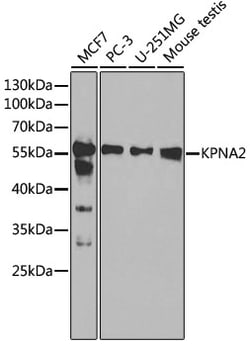 Invitrogen KPNA2 Polyclonal Antibody 100 &mu;L; Unconjugated:Antibodies,