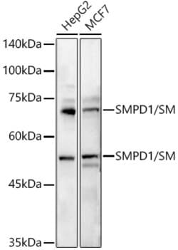Invitrogen ASM Polyclonal Antibody 100 &mu;L; Unconjugated:Anticuerpos