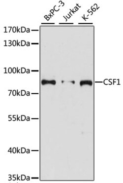 M-CSF Polyclonal Antibody, Invitrogen 100 &mu;L; Unconjugated:Antibodies,