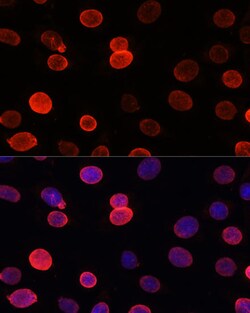 Invitrogen UNC84B Polyclonal Antibody 100 &mu;L; Unconjugated:Antibodies,