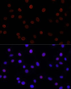 Invitrogen UNC84B Polyclonal Antibody 100 &mu;L; Unconjugated:Antibodies,