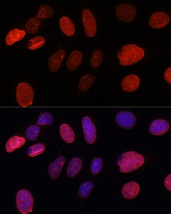 Invitrogen UNC84B Polyclonal Antibody 100 &mu;L; Unconjugated:Antibodies,