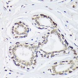 Invitrogen UNC84B Polyclonal Antibody 100 &mu;L; Unconjugated:Antibodies,