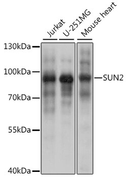 Invitrogen UNC84B Polyclonal Antibody 100 &mu;L; Unconjugated:Antibodies,