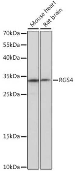 Invitrogen RGS4 Polyclonal Antibody 100 &mu;L; Unconjugated:Antibodies,