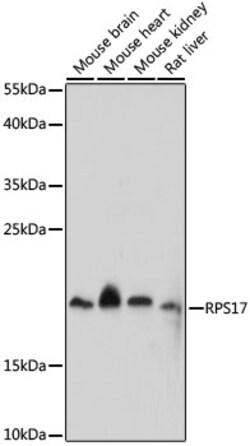 Invitrogen RPS17 Polyclonal Antibody 100 &mu;L | Buy Online | Invitrogen&trade; | Fisher Scientific