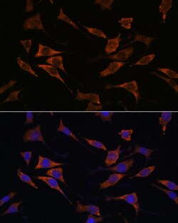 Invitrogen RPS17 Polyclonal Antibody 100 &mu;L; Unconjugated:Antibodies,