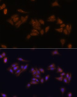 Invitrogen RPS17 Polyclonal Antibody 100 &mu;L; Unconjugated:Antibodies,