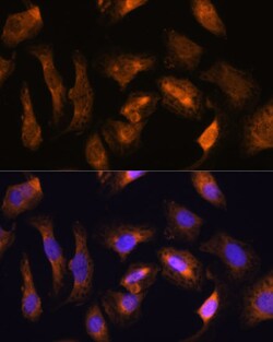 Invitrogen RPS17 Polyclonal Antibody 100 &mu;L; Unconjugated:Antibodies,