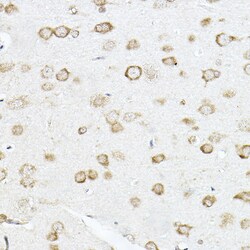 Invitrogen SCD Polyclonal Antibody 100 &mu;L; Unconjugated:Antibodies,