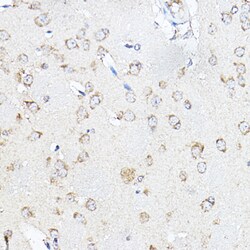 Invitrogen SCD Polyclonal Antibody 100 &mu;L; Unconjugated:Antibodies,