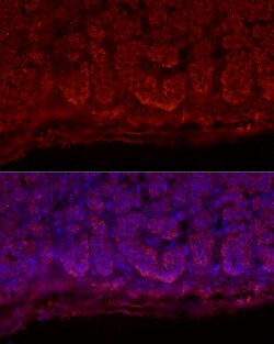 Invitrogen STAR Polyclonal Antibody 100 &mu;L | Buy Online | Invitrogen&trade; | Fisher Scientific
