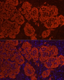 Invitrogen STAR Polyclonal Antibody 100 &mu;L | Buy Online | Invitrogen&trade; | Fisher Scientific