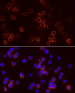 Invitrogen STAR Polyclonal Antibody 100 &mu;L | Buy Online | Invitrogen&trade; | Fisher Scientific