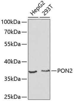 Invitrogen PON2 Polyclonal Antibody 100 &mu;L; Unconjugated:Antibodies,