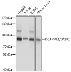 DCLK1 Polyclonal Antibody, Invitrogen 100 &mu;L; Unconjugated:Antibodies,