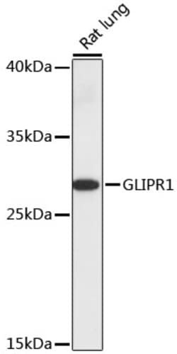 Invitrogen GLIPR1 Polyclonal Antibody 100 &mu;L; Unconjugated:Antibodies,