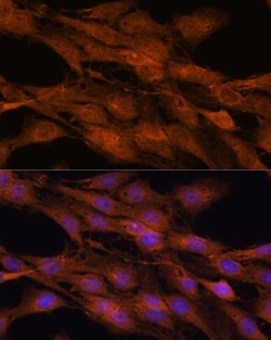 Invitrogen COMMD5 Polyclonal Antibody 100 &mu;L; Unconjugated:Antibodies,