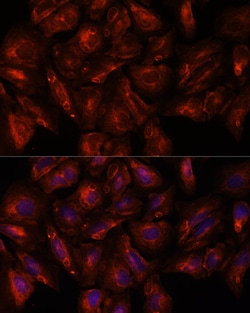 Invitrogen ITSN2 Polyclonal Antibody 100 &mu;L; Unconjugated:Antibodies,