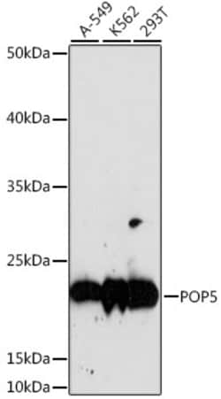 Invitrogen POP5 Polyclonal Antibody 100 &mu;L; Unconjugated:Antibodies,