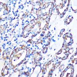 Invitrogen MST4 Polyclonal Antibody 100 &mu;L; Unconjugated:Antibodies,