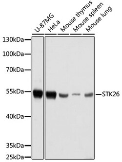 Invitrogen MST4 Polyclonal Antibody 100 &mu;L; Unconjugated:Antibodies,
