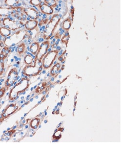 Invitrogen CHDH Polyclonal Antibody 100 &mu;L; Unconjugated:Antibodies,