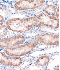 Invitrogen CHDH Polyclonal Antibody 100 &mu;L; Unconjugated:Antibodies,